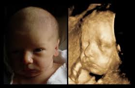 3d ultrasound pictures