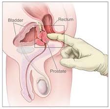 prostatitis stretches