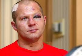 Fedor punished