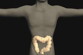 ¿Sabe UD que la muerte puede empezar en los intestinos?