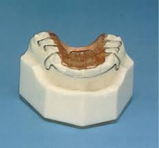 removable orthodontic appliances