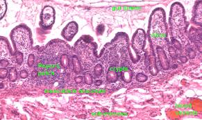 peyers patches