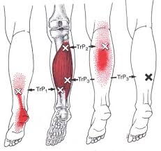 6.4 SOLEUS