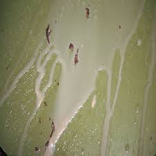 menstrual clots
