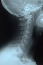 x ray pics