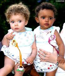 black and white twins