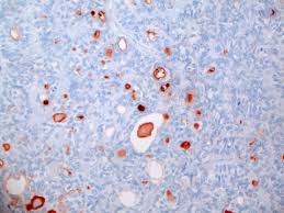 limosuine service fresno ca