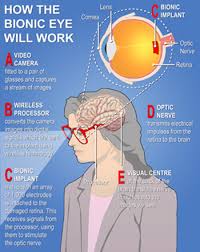 bionic eyes