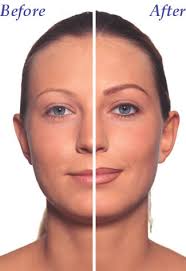 thinning eyebrows
