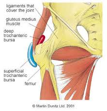bursitis hip