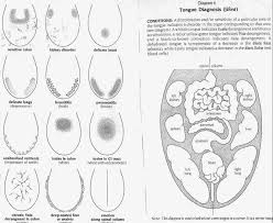 ayurvedic tongue diagnosis