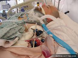 surgical icu