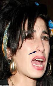 nostril