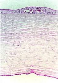 fuchs dystrophy