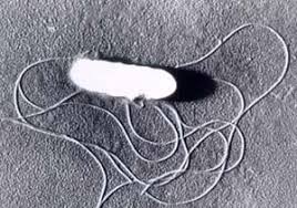 Listeria and Listeriosis
