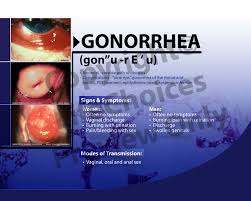 Gonorrhea - TrendMixer