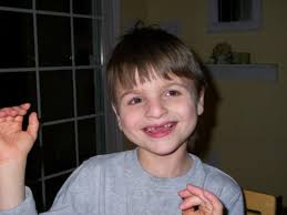 Infants with Angelman syndrome