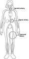 What is <b>angiography</b>?