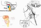 5.1 Tumor de <b>tronco encefálico</b>