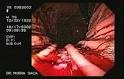 <b>Gastrointestinal Bleeding</b>, Notes on Cyber Gastroenterology, Dr