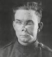 with <b>facial injuries</b>