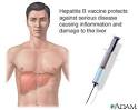 <b>Hepatitis B</b>