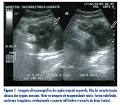 parte da <b>bexiga urinária</b>,