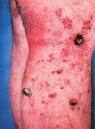 HYLE 9-1 (2003): The Molecular Aesthetics of Disease: The ...