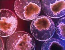 Retina da staminali embrionali