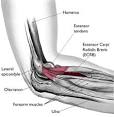 in <b>tennis elbow</b> is called