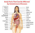 AUTOIMMUNE DISEASEs fact sheet | womenshealth.