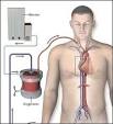<b>sindrome da distress</b>