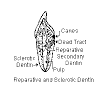 <b>secondary dentin</b>.