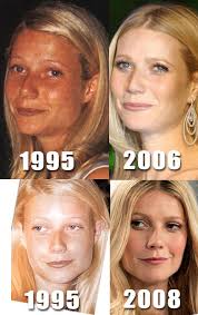 Is this Gwyneth Paltrow before and after plastic surgery?