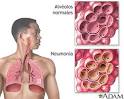 <b>NEUMONIA</b>