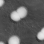 of <b>Neisseria gonorrhoeae</b>