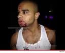 I Don't Fight, I Don't Argue: Raz B Hit In The Face With A Bottle ...