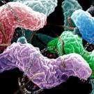 <b>Campylobacter Infections</b> is