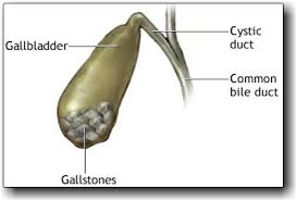 Post image for பித்தப்பை கற்கள் (Galbladder Stones)
