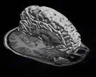 My MRI: Magnetic Resonance Imaging