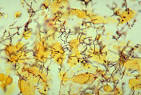 File:<b>Treponema</b> pallidum 01.png