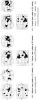 tracer uptake in <b>psychotic</b>
