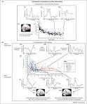 Developmental neuroplasticity after cochlear implantation 10.1016 ...