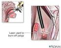 down the <b>laryngoscope</b>.