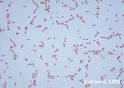 as <b>Serratia marcescens</b> on