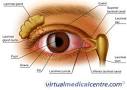 <b>keratoconjunctivitis sicca</b>