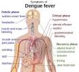 Dengue fever - Wikipedia, the free encyclopedia