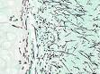 invasive <b>aspergillosis</b> in