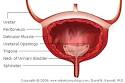 <b>Bladder Cancer</b> Causes