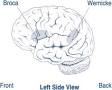 <b>Broca's</b> and Wernicke's <b>aphasia</b>